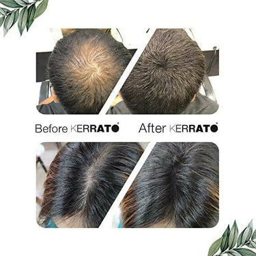 https://cdn.shopify.com/s/files/1/1857/6931/products/bRB5CkvSJB.jpg?v=1706592052